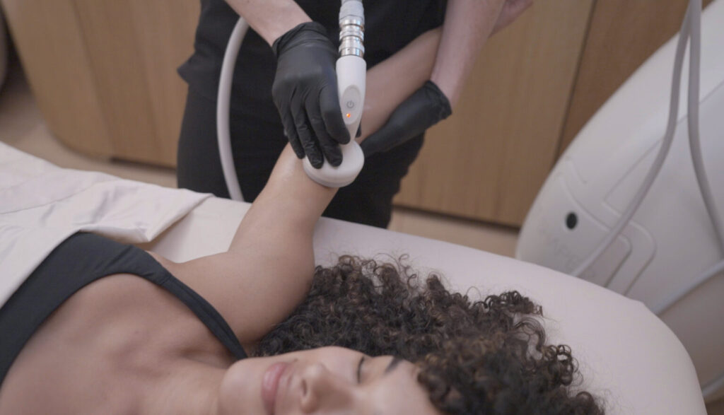 T-Shape Is Rekindle's Arm Skin Tightening Service