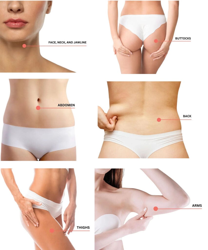 T Shape Treatment Areas