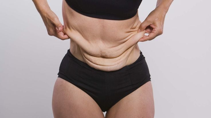 Tighten Skin After Weight Loss Non Surgical
