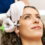 Best Dermal Fillers Tucson