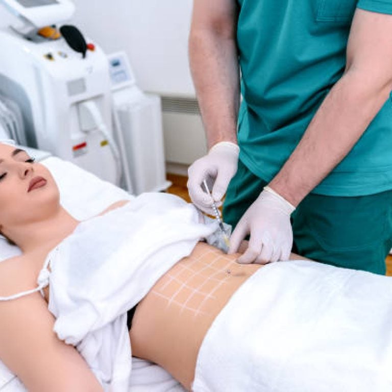 The doctor cosmetologist makes botox injections and rejuvenation in the stomach of a woman. Smoothing wrinkles and wrinkles on the abdomen with the help of hyaluronic acid rejuvenation injections