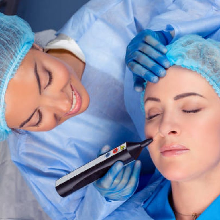 Woman having a non surgical procedure to remove nasolabial wrinkles with a laser device by a cosmetologist in a medical clinic. Thread lift procedure. Patient with eyes closed having lifting procedure