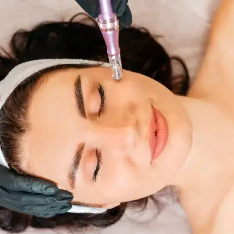 Your Guide to Microneedling Treatment in Tucson